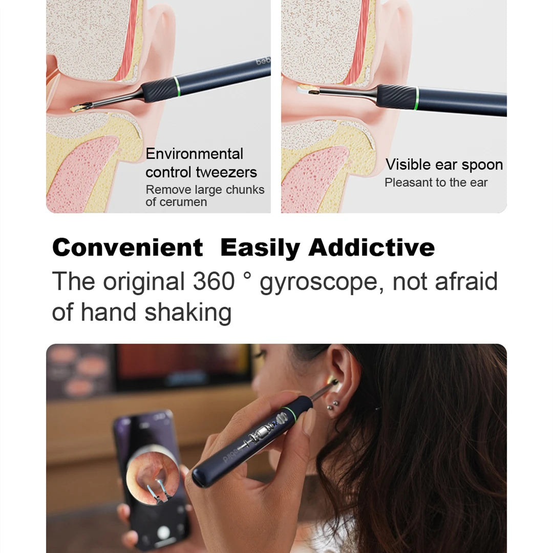 Bebird Note5 Pro Ear Cleaner Smart Visual Ear Wax Sticks Endoscope Tweezers Earpick Mini Camera Otoscope Personal Health Care